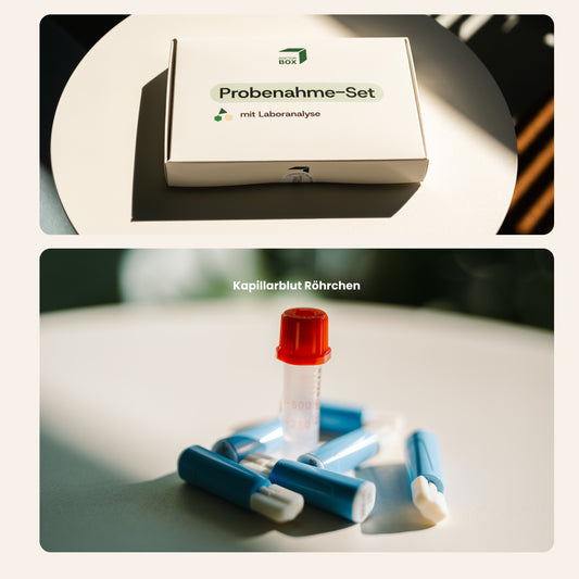 Allergietest (295 Allergene)