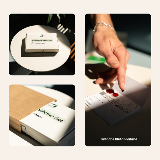 PSA test - prostate screening